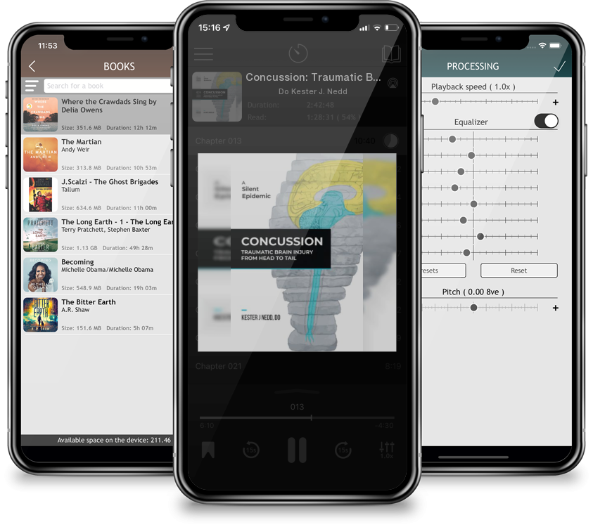 Audiobook Concussion: Traumatic Brain Injury from Head to Tail by Do Kester J. Nedd